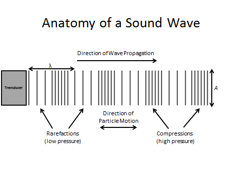 anatomy of a sound